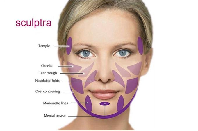 حشوات سكلبترا دبي