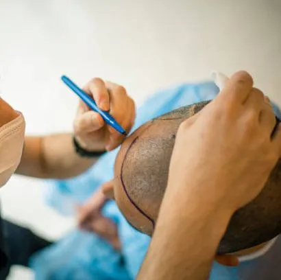 تكلفة زراعة الشعر في منطقة التاج في دبي