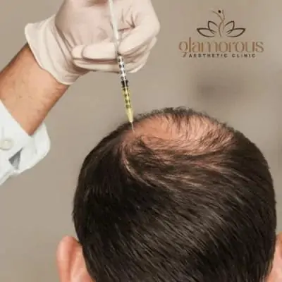 Cheapest Exosomes Treatment in Dubai