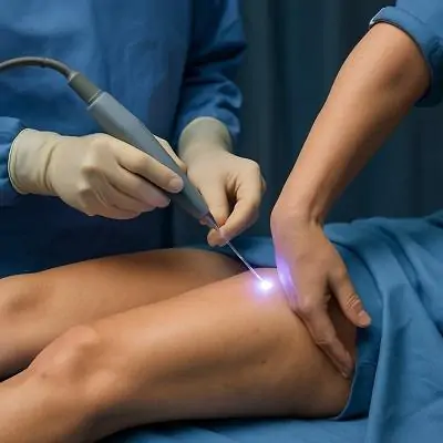 تقنية J-Plasma لشد الفخذين والذراعين في دبي
