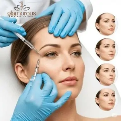 Teoxane Dermal Fillers in Dubai