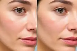 ,.نتائج علاج تبييض الجسم في دبي