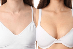 Best Breast Fillers Injections Dubai