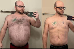 Best Clinic of Mounjaro Injections Dubai