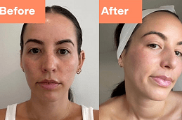 Deep Cleansing Facial Dubai