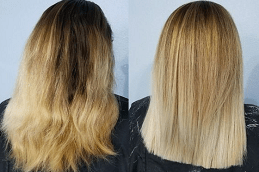 Hair Botox Treatment in Dubai