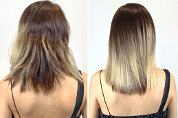 Hair Botox Treatment in UAE Dubai