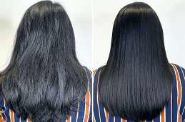 Hair Botox Treatment in UAE