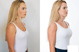 How Much Does Breast Injections Dubai