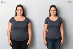 Mounjaro Injections in Dubai