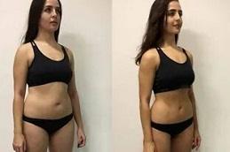 Zepbound Mounjaro for Weight Loss in Dubai uae