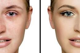 Best Glutathione Pills for Skin Whitening in Dubai