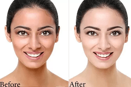 Glutathione Pills for Skin Whitening in Dubai