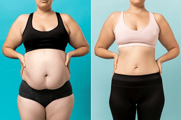 Weight Loss Injections Cost Dubai