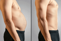 Emsculpt Neo in UAE Dubai