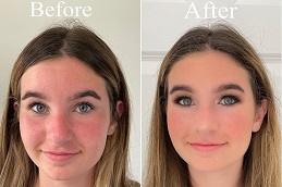 Best Deep Cleansing Facial in Dubai Abu Dhabi 1