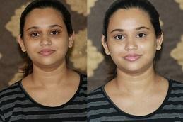 Deep Cleansing Facial in Dubai Abu Dhabi 1