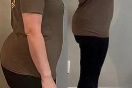 Best Ozempic Injection in Dubai & Abu-Dhabi