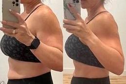 Ozampic Injection in Dubai