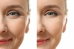 Permanent Skin Whitening Treatment Clinic in Dubai 1