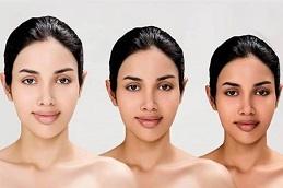 Results of Body Whitening Treatment clinic in Dubai
