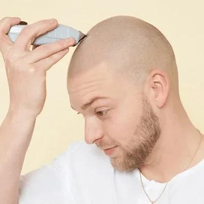 Scalp MicroPigmentation (SMP) Cost in Dubai & Abu Dhabi