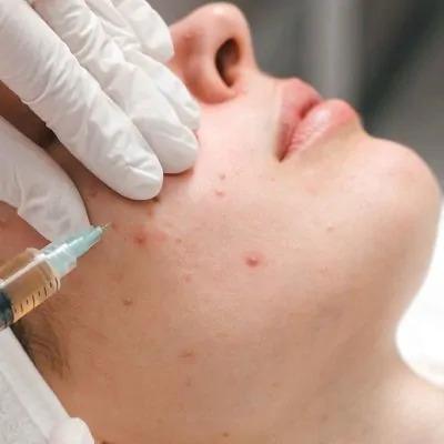 Steroid Injections in Dubai Abu Dhabi Corticosteroid