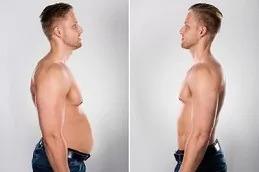 Fat Melting Injections Dubai & Abu Dhabi