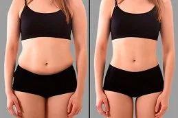 Fat Melting Injections before & After
