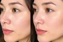 Results of Karisma for Skin Dubai,