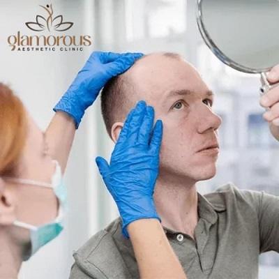 Top Scalp Micropigmentation Experts in Dubai & Abu Dhabi