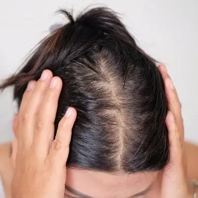 Best Hair Treatment in Dubai for Females