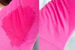 Botox Injections for Hyperhidrosis in Dubai & Abu Dhabi