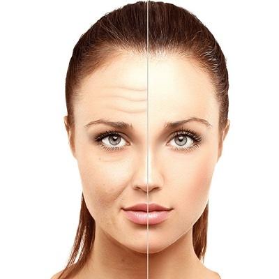 Decolletage Anti-Aging in Dubai