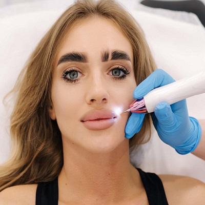 Plasma Pen Treatment in Dubai & Abu Dhabi