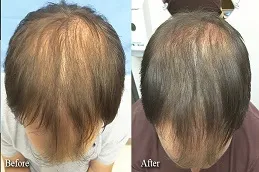 Results Will PRGF Look Natural Dubai