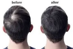 Results Will PRGF Look Natural Dubai,