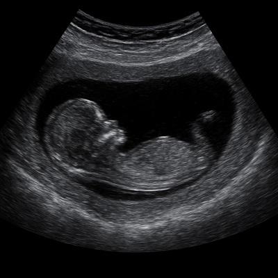 Vaginal & Pregnancy Ultrasound in Dubai & Sharjah