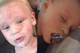 Baby Skin Facial before & After clinic Dubai