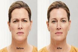 Best American Hair Transplant Clinic Dubai'