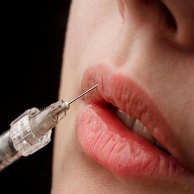 Best American Lip Fillers in Dubai