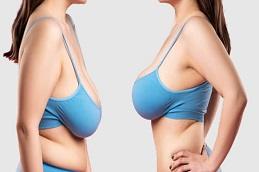 Breast Reconstruction before & After clinic Dubai