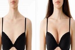 Breast Reconstruction before & After