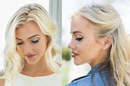 Female Hair Transplant before & after Dubai,