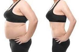 Generic Mounjaro Before & After in Dubai