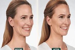 Gut Cleanse IV Drip clinic before & After in Dubai