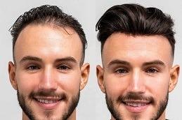 Human Hair Wigs before & After in Dubai
