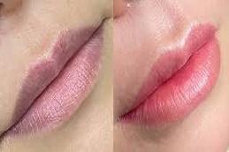 Lip Blushing Treatment before & after clinic