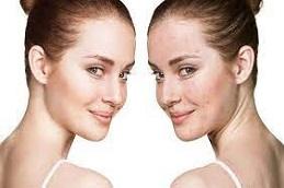 Red Carpet Facial before & after clinic in Dubai