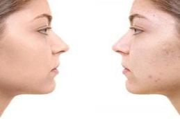Red Carpet Facial clinic in Dubai